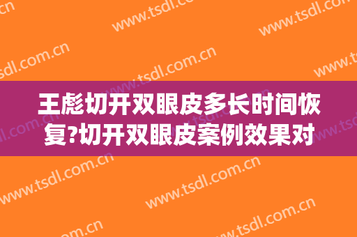王彪切开双眼皮多长时间恢复?切开双眼皮案例效果对比图_福建医科大学附属第一医院