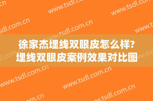 徐家杰埋线双眼皮怎么样?埋线双眼皮案例效果对比图_中国医学科学院整形外科医院