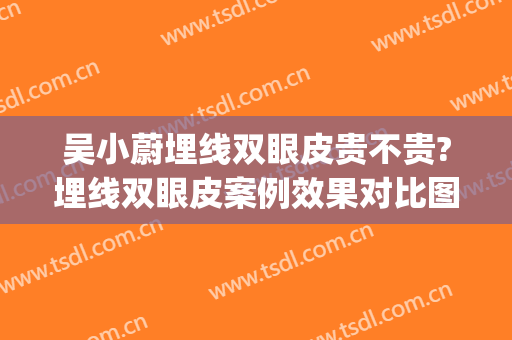 吴小蔚埋线双眼皮贵不贵?埋线双眼皮案例效果对比图_武汉大学人民医院