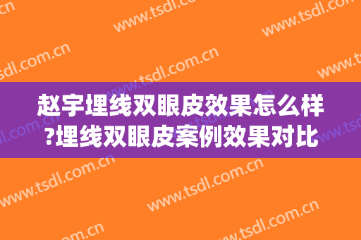 赵宇埋线双眼皮效果怎么样?埋线双眼皮案例效果对比图_安徽医科大学第一附属医院