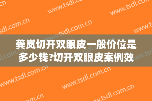 龚岚切开双眼皮一般价位是多少钱?切开双眼皮案例效果对比图_复旦大学附属眼耳鼻喉科医院
