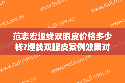 范志宏埋线双眼皮价格多少钱?埋线双眼皮案例效果对比图_上海交通大学医学院附属仁济医院
