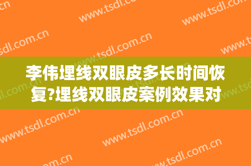 李伟埋线双眼皮多长时间恢复?埋线双眼皮案例效果对比图_上海交通大学医学院附属第九人民医院