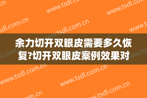 余力切开双眼皮需要多久恢复?切开双眼皮案例效果对比图_上海交通大学医学院附属第九人民医院