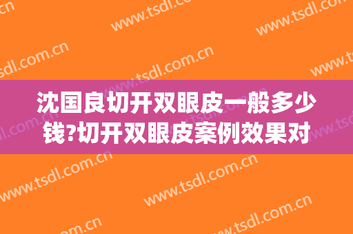 沈国良切开双眼皮一般多少钱?切开双眼皮案例效果对比图_苏州大学附属第一医院