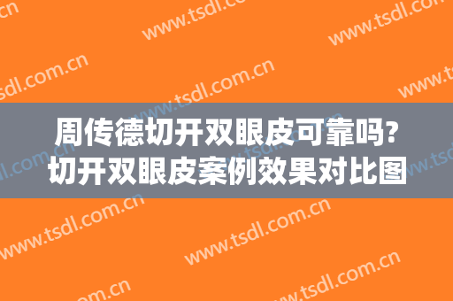 周传德切开双眼皮可靠吗?切开双眼皮案例效果对比图_中国医学科学院整形外科医院