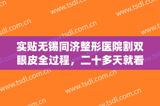 实贴无锡同济整形医院割双眼皮全过程，二十多天就看不出痕迹了(无锡第二人民医院割双眼皮)