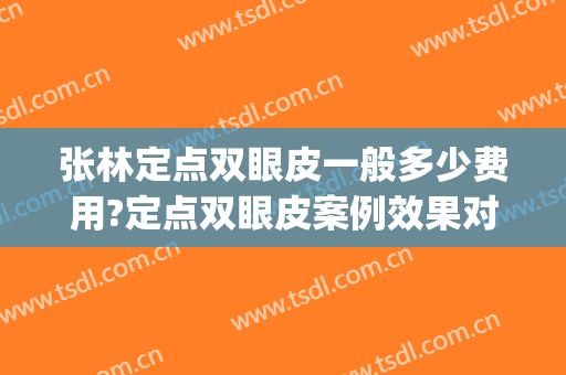 张林定点双眼皮一般多少费用?定点双眼皮案例效果对比图_安徽医科大学第一附属医院