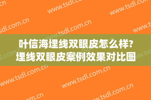 叶信海埋线双眼皮怎么样?埋线双眼皮案例效果对比图_复旦大学附属眼耳鼻喉科医院