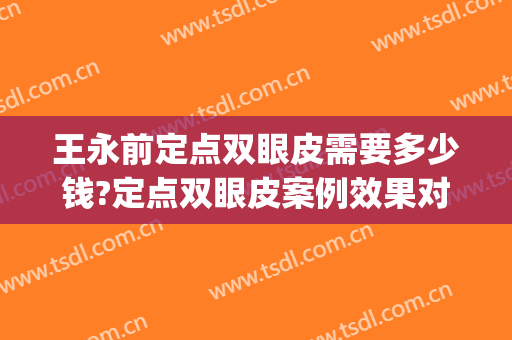 王永前定点双眼皮需要多少钱?定点双眼皮案例效果对比图_中国医学科学院整形外科医院