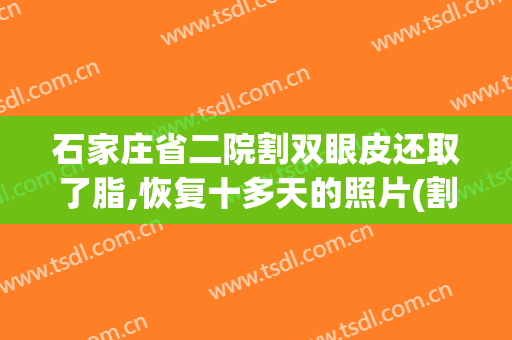 石家庄省二院割双眼皮还取了脂,恢复十多天的照片(割双眼皮恢复过程图片)