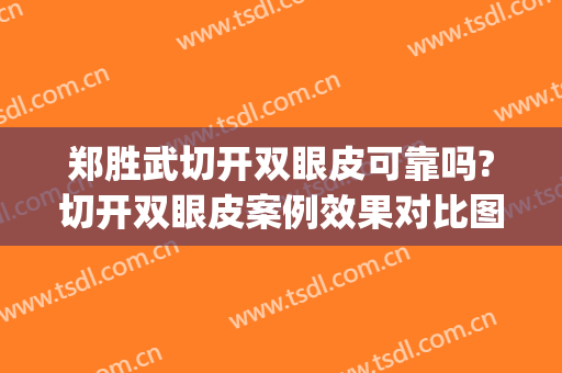 郑胜武切开双眼皮可靠吗?切开双眼皮案例效果对比图_福建省立医院(切开割双眼皮医院)
