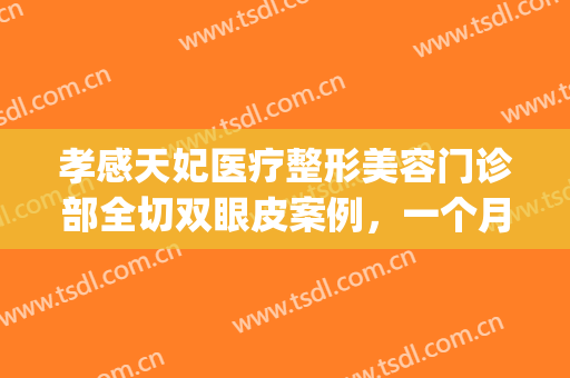 孝感天妃医疗整形美容门诊部全切双眼皮案例，一个月恢复图！(孝感割双眼皮多少钱)