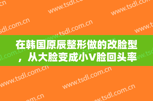 在韩国原辰整形做的改脸型，从大脸变成小V脸回头率超高