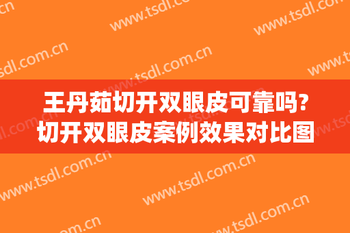 王丹茹切开双眼皮可靠吗?切开双眼皮案例效果对比图_上海交通大学医学院附属第九人民医院