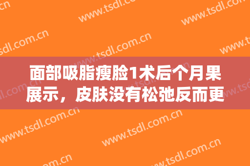 面部吸脂瘦脸1术后个月果展示，皮肤没有松弛反而更紧致(面部吸脂后没变化)
