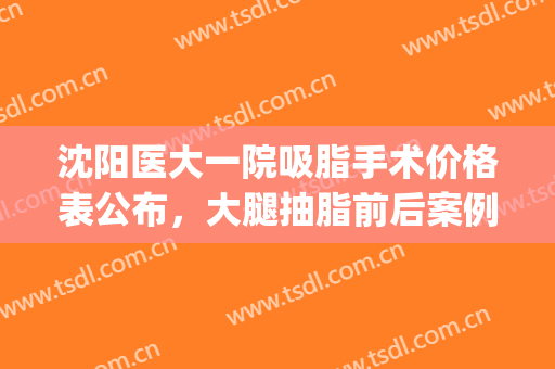 沈阳医大一院吸脂手术价格表公布，大腿抽脂前后案例对比图(沈阳面部吸脂哪个医生做得好)