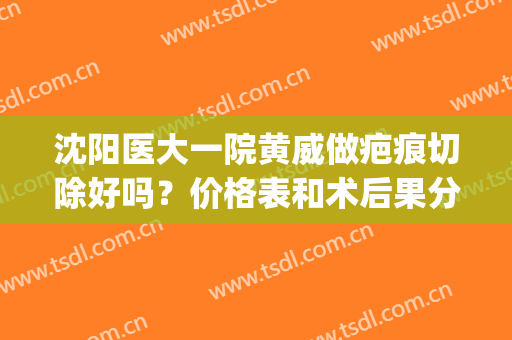 沈阳医大一院黄威做疤痕切除好吗？价格表和术后果分享(沈阳医大一院整形外科黄威)