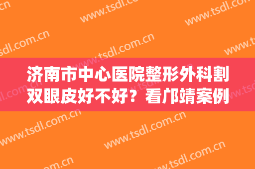 济南市中心医院整形外科割双眼皮好不好？看邝靖案例描述(济南割双眼皮哪个医生好)