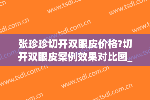 张珍珍切开双眼皮价格?切开双眼皮案例效果对比图_复旦大学附属眼耳鼻喉科医院