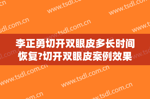 李正勇切开双眼皮多长时间恢复?切开双眼皮案例效果对比图_四川大学华西医院