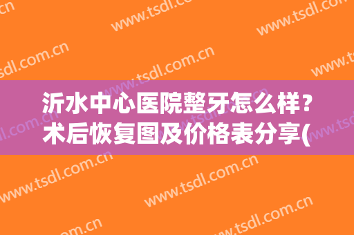 沂水中心医院整牙怎么样？术后恢复图及价格表分享(沂水中心医院洗牙多少钱啊)