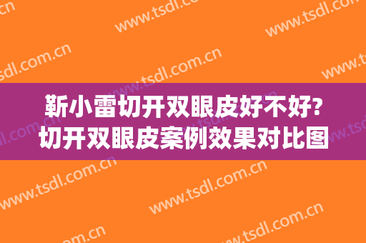 靳小雷切开双眼皮好不好?切开双眼皮案例效果对比图_中国医学科学院整形外科医院