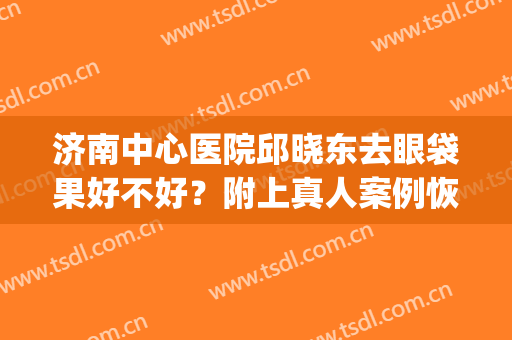 济南中心医院邱晓东去眼袋果好不好？附上真人案例恢复图(济南邱晓东双眼皮)