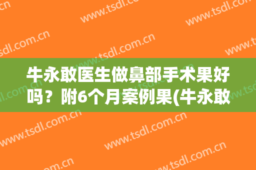 牛永敢医生做鼻部手术果好吗？附6个月案例果(牛永敢做鼻子案例)