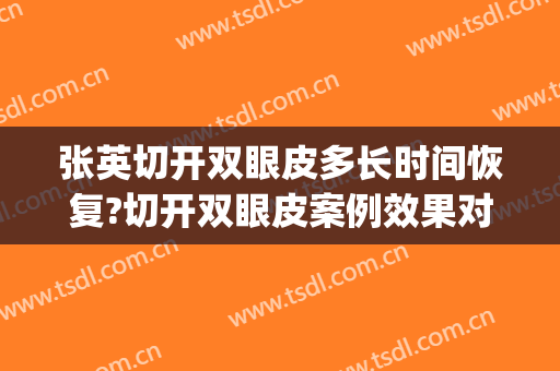张英切开双眼皮多长时间恢复?切开双眼皮案例效果对比图_上海交通大学医学院附属第九人民医院