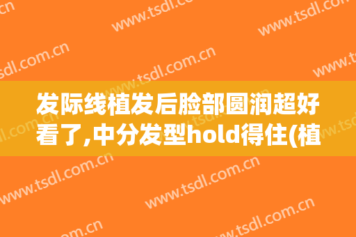 发际线植发后脸部圆润超好看了,中分发型hold得住(植发后的发际线)