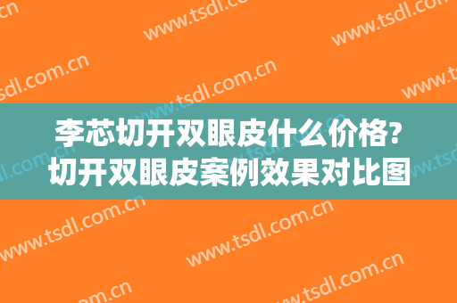 李芯切开双眼皮什么价格?切开双眼皮案例效果对比图_中国医学科学院整形外科医院