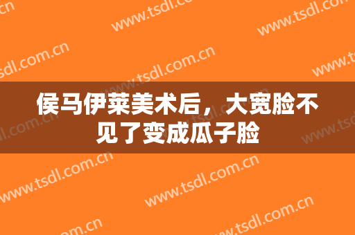 侯马伊莱美术后，大宽脸不见了变成瓜子脸