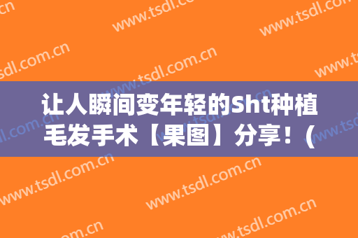 让人瞬间变年轻的Sht种植毛发手术【果图】分享！(Sht植发)