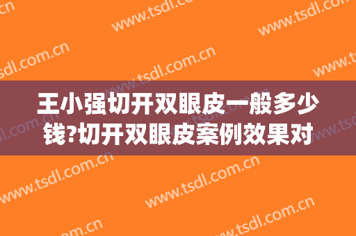 王小强切开双眼皮一般多少钱?切开双眼皮案例效果对比图_天津市眼科医院