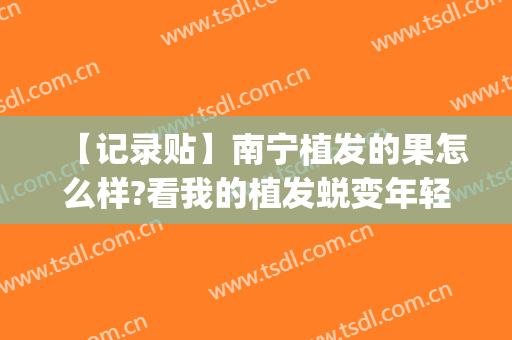 【记录贴】南宁植发的果怎么样?看我的植发蜕变年轻过程(南宁哪家植发比较好)