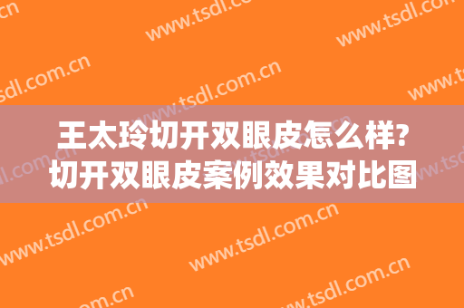 王太玲切开双眼皮怎么样?切开双眼皮案例效果对比图_中国医学科学院整形外科医院