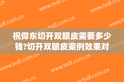 祝仰东切开双眼皮需要多少钱?切开双眼皮案例效果对比图_哈尔滨医科大学附属第一医院