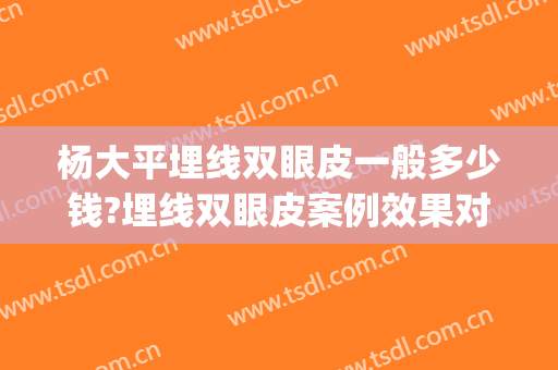 杨大平埋线双眼皮一般多少钱?埋线双眼皮案例效果对比图_北京联合丽格第一医疗美容医院