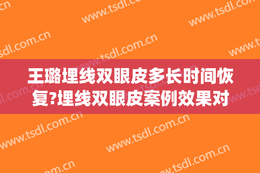 王璐埋线双眼皮多长时间恢复?埋线双眼皮案例效果对比图_好大夫工作室