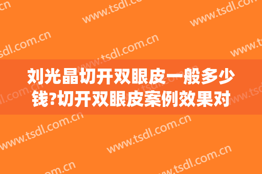 刘光晶切开双眼皮一般多少钱?切开双眼皮案例效果对比图_天津市第一中心医院
