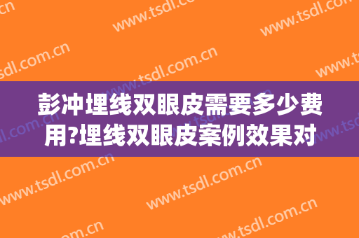 彭冲埋线双眼皮需要多少费用?埋线双眼皮案例效果对比图_华中科技大学同济医学院附属协和医院