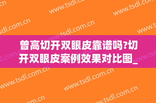 曾高切开双眼皮靠谱吗?切开双眼皮案例效果对比图_中日友好医院(全切双眼皮过宽)