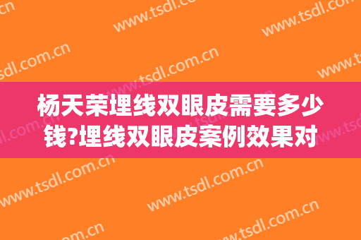 杨天荣埋线双眼皮需要多少钱?埋线双眼皮案例效果对比图_重庆医科大学附属第一医院