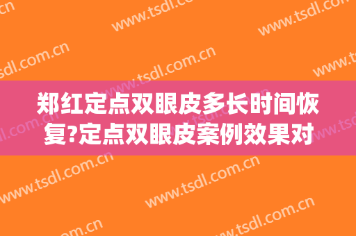 郑红定点双眼皮多长时间恢复?定点双眼皮案例效果对比图_安庆市立医院