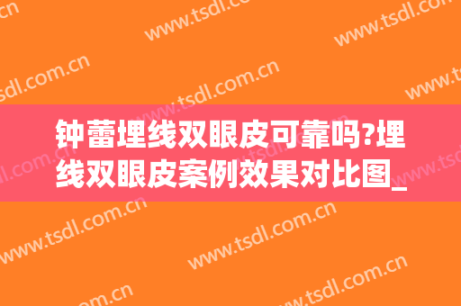 钟蕾埋线双眼皮可靠吗?埋线双眼皮案例效果对比图_苏州大学附属第一医院