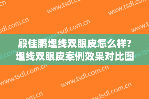 殷佳鹏埋线双眼皮怎么样?埋线双眼皮案例效果对比图_厦门大学附属第一医院
