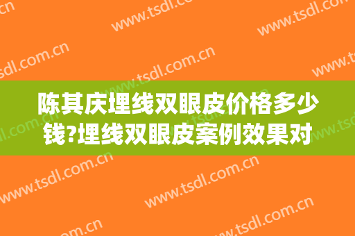 陈其庆埋线双眼皮价格多少钱?埋线双眼皮案例效果对比图_南方医科大学南方医院