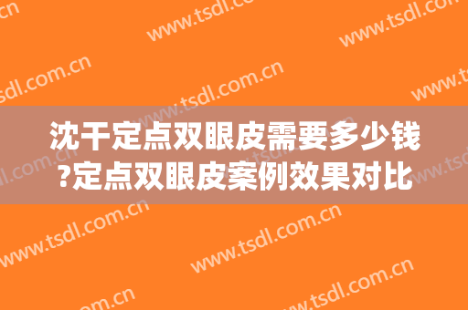 沈干定点双眼皮需要多少钱?定点双眼皮案例效果对比图_南京医科大学第二附属医院