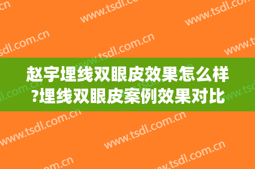 赵宇埋线双眼皮效果怎么样?埋线双眼皮案例效果对比图_中国医科大学附属盛京医院